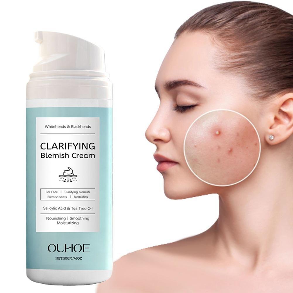 Salicylic Acid Blackhead Remover - サリチル酸ニキビ除去クリーム 栄養補給 軽量 ノンオイリー サリチル酸配合 白ニキビ黒ニキビ用クリーム